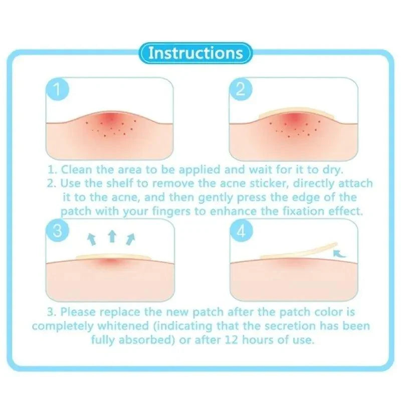 Face Acne Pimple Spot Scar Care Treatment Stickers